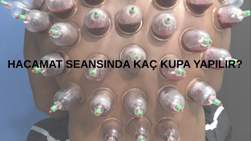 Hacamat ilk seansta kaç kupa yapılır?