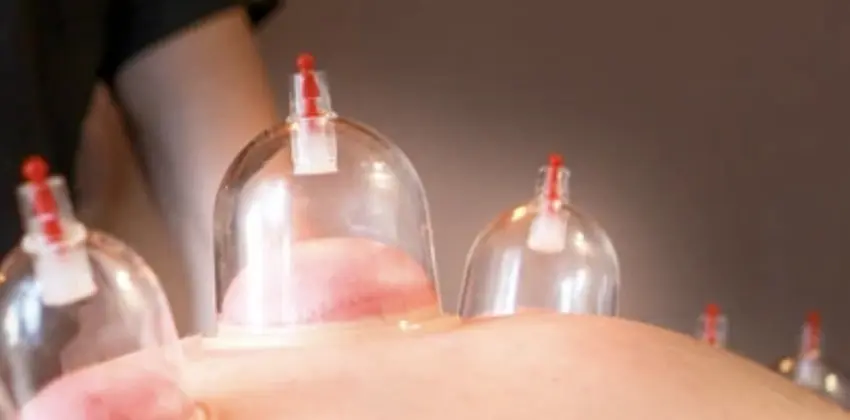 Hacamat Enstitusu Avrupa