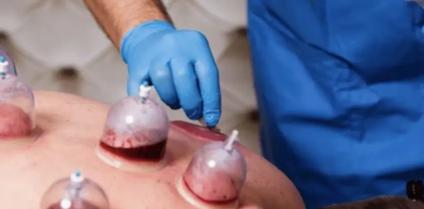 Hacamat Enstitusu Avrupa