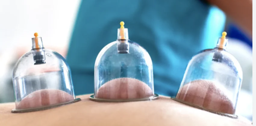 Hacamat Enstitusu Avrupa