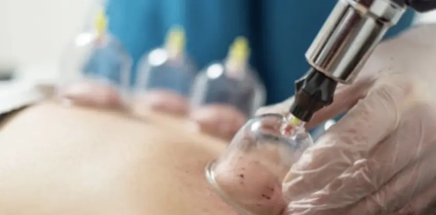 Hacamat Enstitusu Avrupa