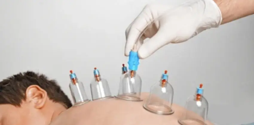 Hacamat Enstitusu Avrupa